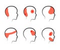 Types of headaches on a white background. Silhouette. Vector